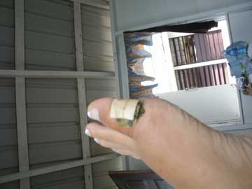 my-foot-issue